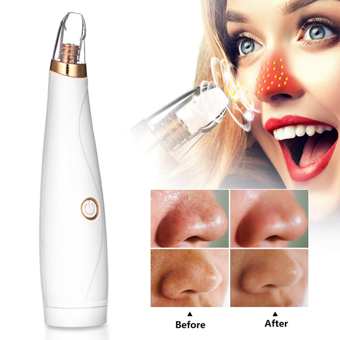 Blackhead Remover Face Deep Pore Cleaner Acne Pimple Removal Vacuum Suction Facial SPA Diamond Beauty Care Tool Skin Care
