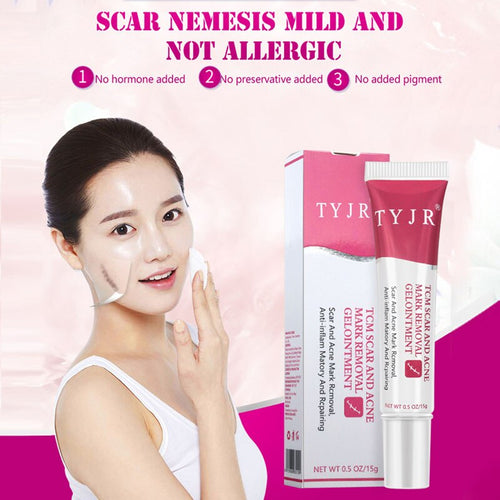 Acne  Removal Cream Repair Cream Burn  Blemishes Stretch Mark Whitening Face Cream HB88