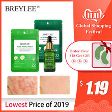 Load image into Gallery viewer, BREYLEE Acne Pimple Patch Acne Treatment Serum Essence Face Mask Skin Care Pimple Remover Tool Whitening Facial Serum Stickers